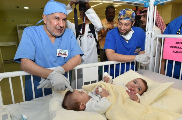 One of the operations for separating conjoined twins in the Kingdom. (SPA)